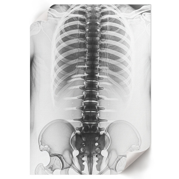 Plakat premium Zdjęcie rentgenowskie