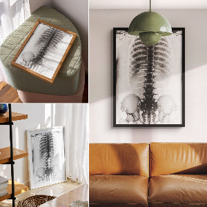 Plakat premium Zdjęcie rentgenowskie