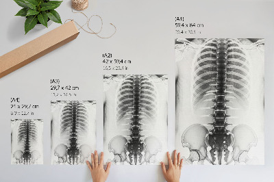 Plakat premium Zdjęcie rentgenowskie